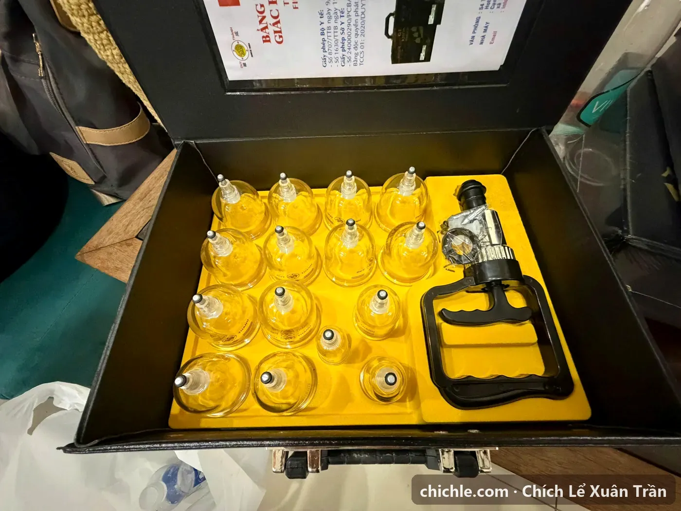 Bộ cốc giác hơi không dùng lửa trong vali dùng phối hợp khi chích lể giác hơi