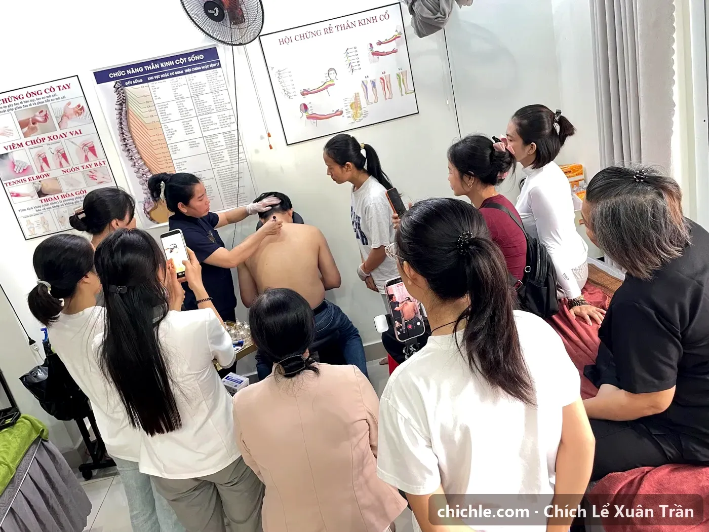 Học viên quan sát thực hành chích lể vùng cổ vai gáy tại lớp — tìm hiểu chích lể chữa bệnh gì