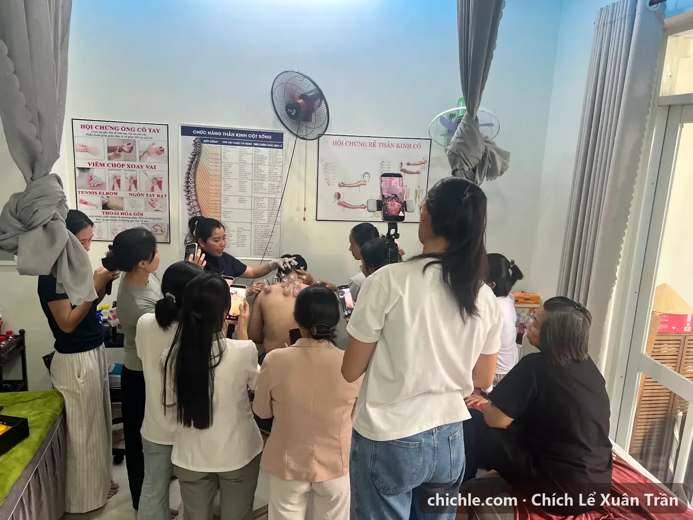 Học viên lớp chích lể quan sát kỹ thuật giác hơi vùng lưng tại lớp – chích lể giác hơi đúng quy trình